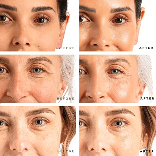 Tree of Life Vitamin C Serum, Retinol Serum & Hyaluronic Acid Serum for Face - Face Serum for Women Anti Aging Skin Care Set Facial Serum, Power Trio Face Serums for Anti Aging - Pack of 3, 2 Fl Oz